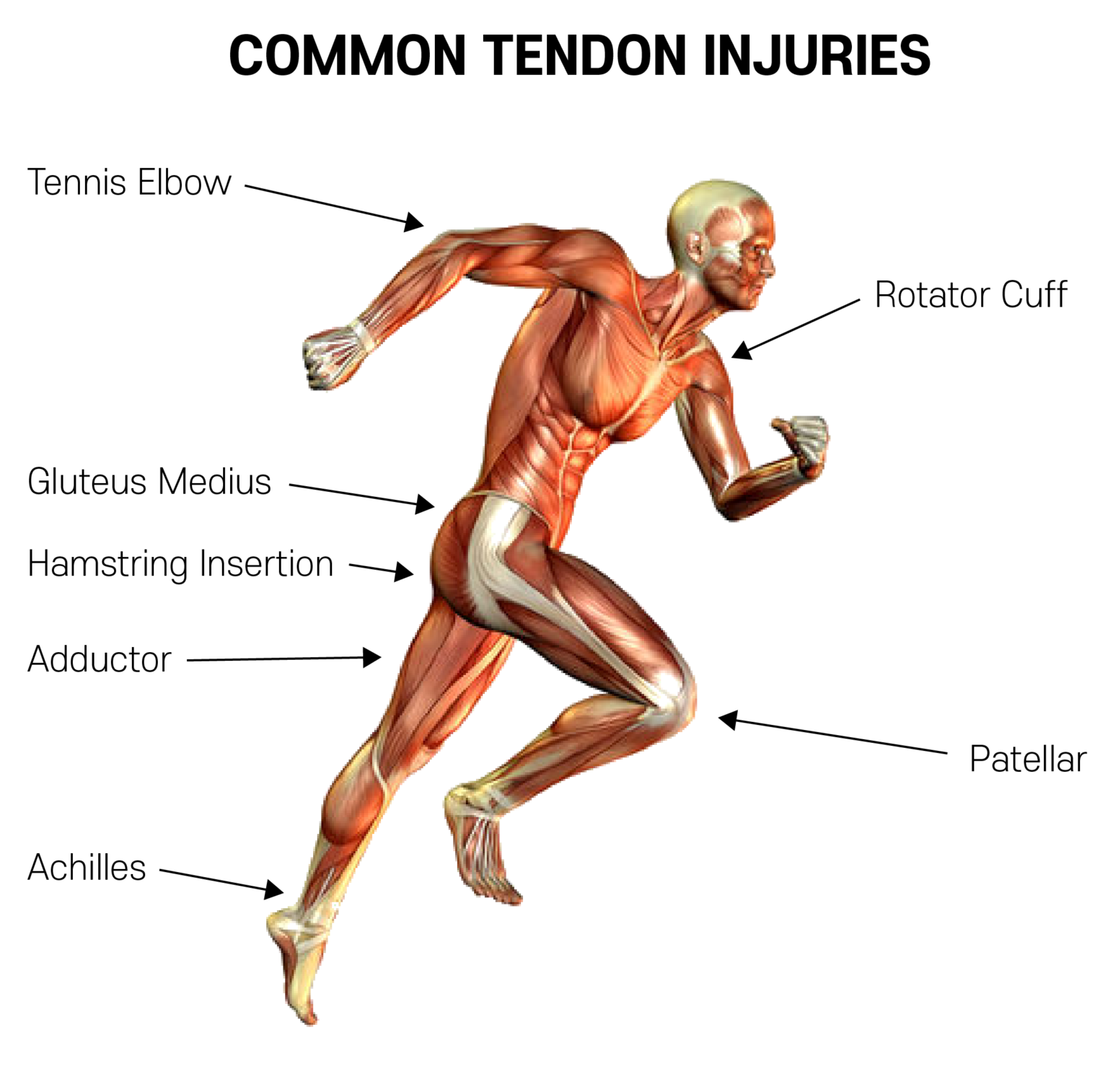 Treating Tendinopathy with Physical Therapy - Korehab Clinic ...