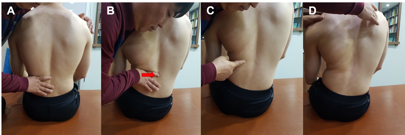 Body Alignment 3