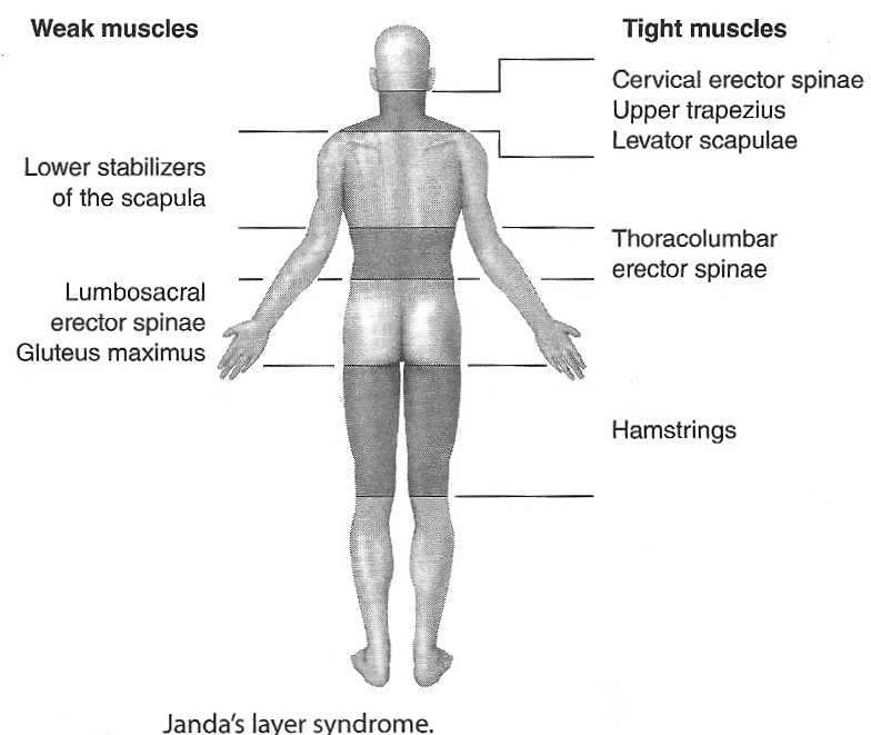Body Alignment 5