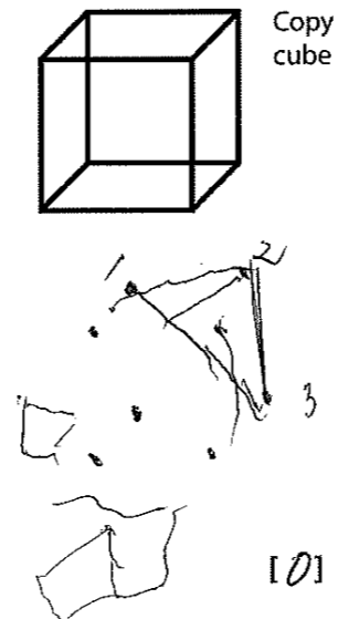 Cognitive Rehabilitation - Symptoms, Causes, Treatment 4 4 1. Treatment Before Copy Cube