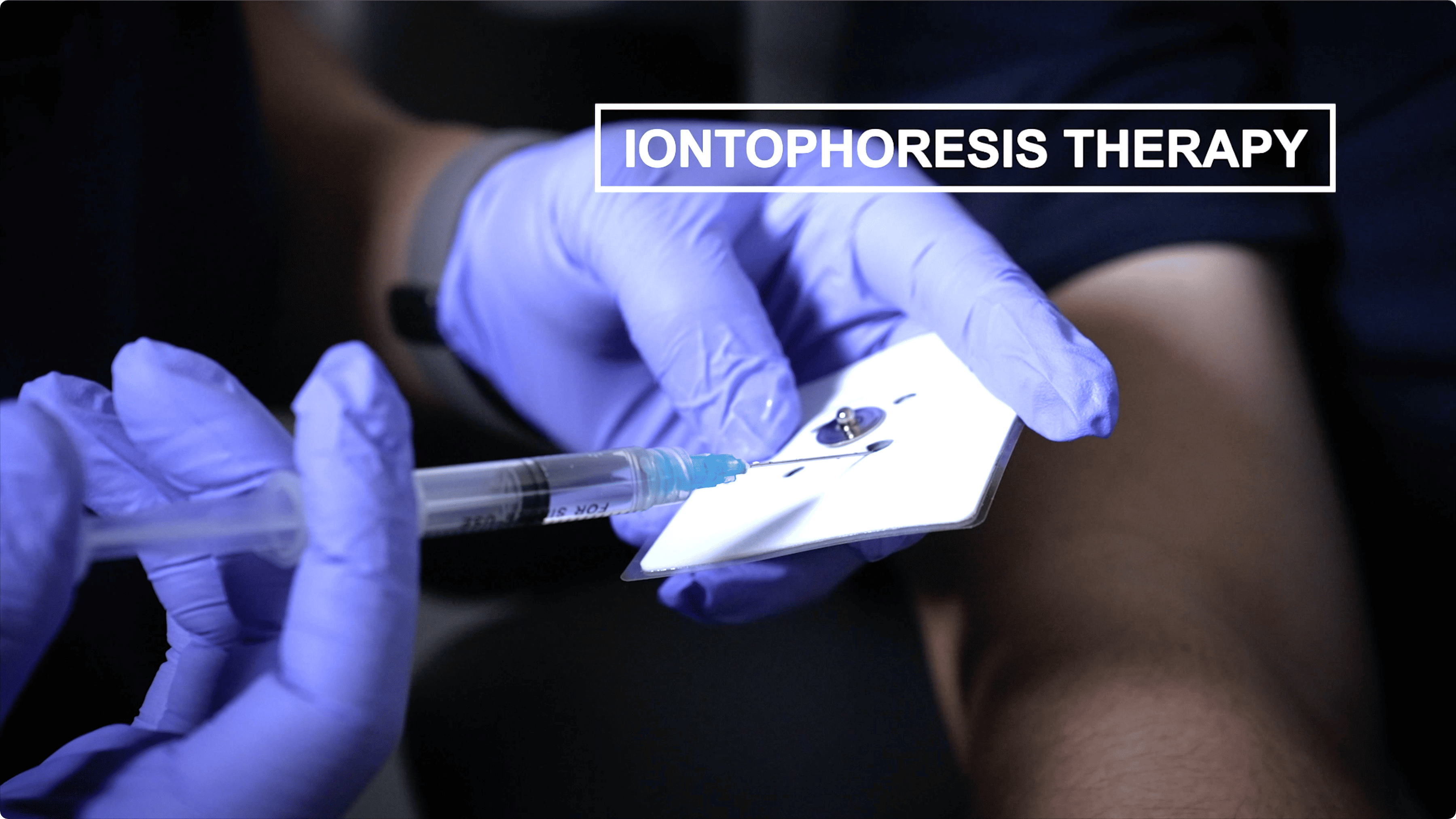 (Treatments_Physiotherapy Services_Thumnail and Article Photo) Iontophoresis Therapy